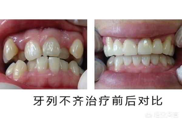 上海最新24小时牙医在线咨询方法分析(最方便真实的上海有没有24小时牙医方法)