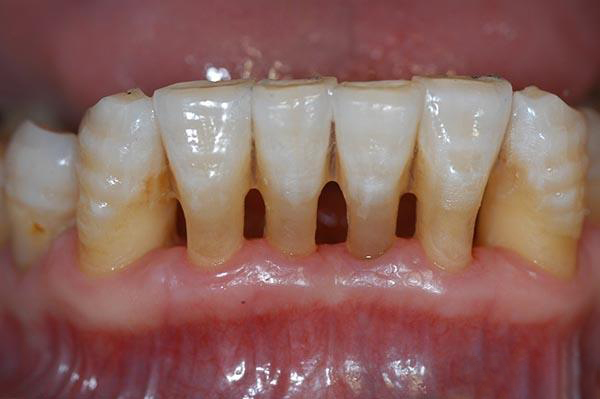 上海最新24小时牙医在线咨询方法分析(最方便真实的上海有没有24小时牙医方法)